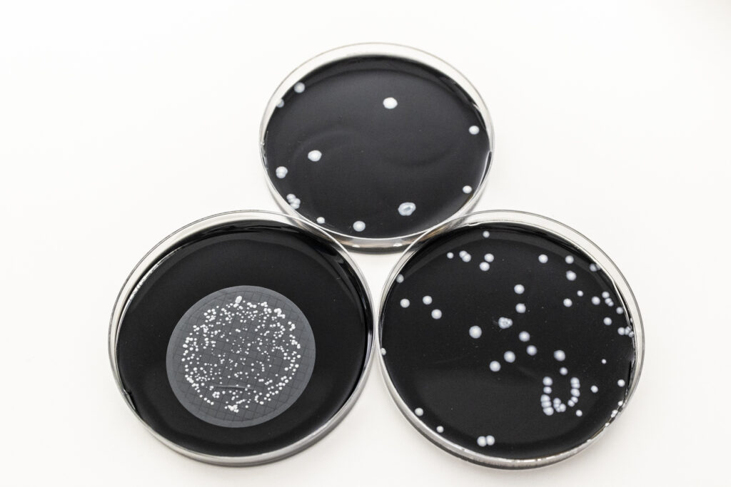 Drei Petrischalen mit schwarzem Nährboden und hellen Bakterienkolonien; unten links ein Membranfilter – kulturbasierter Legionellen-Nachweis.